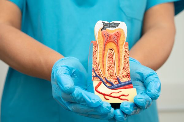 When Dental Pain May Indicate The Need For A Root Canal